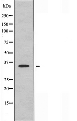 OR11H1+2+12 Antibody - Western blot analysis of extracts of Jurkat cells using OR11H1/11H2/11H12 antibody.