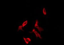 OR11H1+2+12 Antibody - Staining HeLa cells by IF/ICC. The samples were fixed with PFA and permeabilized in 0.1% Triton X-100, then blocked in 10% serum for 45 min at 25°C. The primary antibody was diluted at 1:200 and incubated with the sample for 1 hour at 37°C. An Alexa Fluor 594 conjugated goat anti-rabbit IgG (H+L) Ab, diluted at 1/600, was used as the secondary antibody.