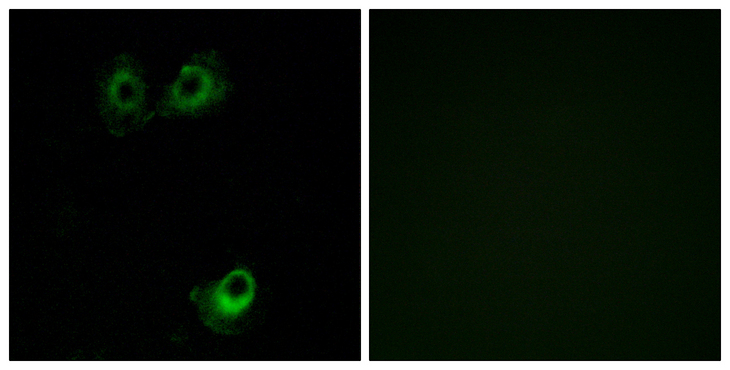 OR11L1 Antibody - Immunofluorescence analysis of A549 cells, using OR11L1 Antibody. The picture on the right is blocked with the synthesized peptide.
