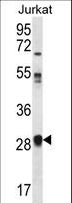 OR11L1 Antibody - OR11L1 Antibody western blot of Jurkat cell line lysates (35 ug/lane). The OR11L1 antibody detected the OR11L1 protein (arrow).