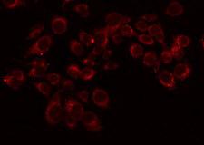 OR11L1 Antibody - Staining LOVO cells by IF/ICC. The samples were fixed with PFA and permeabilized in 0.1% Triton X-100, then blocked in 10% serum for 45 min at 25°C. The primary antibody was diluted at 1:200 and incubated with the sample for 1 hour at 37°C. An Alexa Fluor 594 conjugated goat anti-rabbit IgG (H+L) Ab, diluted at 1/600, was used as the secondary antibody.