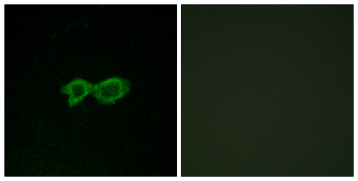 OR13C4 / OR2K1 Antibody - Immunofluorescence analysis of LOVO cells, using OR13C4 Antibody. The picture on the right is blocked with the synthesized peptide.