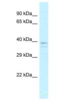 OR13C5 Antibody - OR13C5 antibody Western Blot of HeLa. Antibody dilution: 1 ug/ml.  This image was taken for the unconjugated form of this product. Other forms have not been tested.
