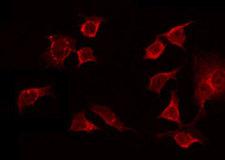OR13C8 Antibody - Staining NIH-3T3 cells by IF/ICC. The samples were fixed with PFA and permeabilized in 0.1% Triton X-100, then blocked in 10% serum for 45 min at 25°C. The primary antibody was diluted at 1:200 and incubated with the sample for 1 hour at 37°C. An Alexa Fluor 594 conjugated goat anti-rabbit IgG (H+L) Ab, diluted at 1/600, was used as the secondary antibody.