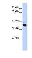 OR13C9 Antibody - OR13C9 antibody Western blot of Fetal Heart lysate. This image was taken for the unconjugated form of this product. Other forms have not been tested.