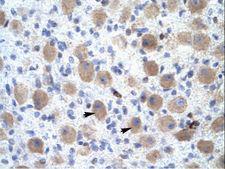 OR13C9 Antibody - OR13C9 antibody ARP31898_T100-NP_001001956-OR13C9 (olfactory receptor, family 13, subfamily C, member 9) Antibody was used in IHC to stain formalin-fixed, paraffin-embedded human brain.  This image was taken for the unconjugated form of this product. Other forms have not been tested.