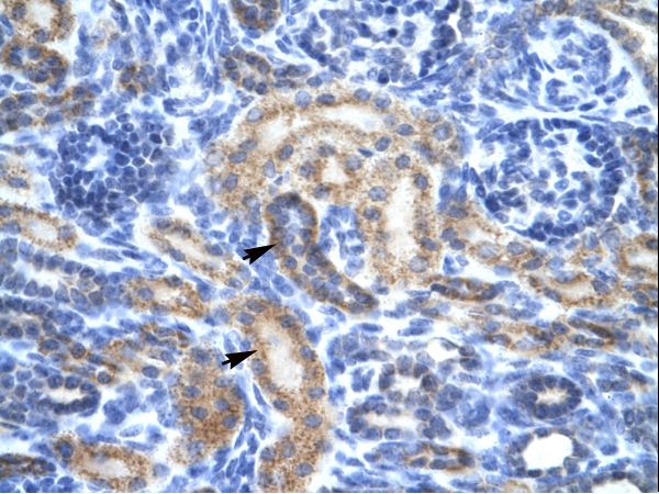 OR13C9 Antibody - OR13C9 antibody ARP31898_T100-NP_001001956-OR13C9 (olfactory receptor, family 13, subfamily C, member 9) Antibody was used in IHC to stain formalin-fixed, paraffin-embedded human kidney.  This image was taken for the unconjugated form of this product. Other forms have not been tested.