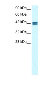 OR13C9 Antibody - OR13C9 antibody Western blot of HepG2 cell lysate. This image was taken for the unconjugated form of this product. Other forms have not been tested.