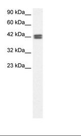 OR13C9 Antibody - Fetal Kidney Lysate.  This image was taken for the unconjugated form of this product. Other forms have not been tested.
