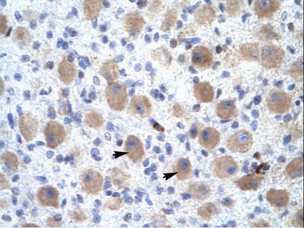 OR13C9 Antibody - OR13C9 antibody ARP31898_T100-NP_001001956-OR13C9 (olfactory receptor, family 13, subfamily C, member 9) Antibody was used in IHC to stain formalin-fixed, paraffin-embedded human brain.  This image was taken for the unconjugated form of this product. Other forms have not been tested.