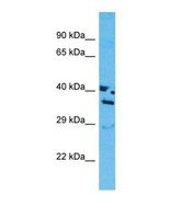 OR13J1 Antibody - Western blot of Human MCF7. OR13J1 antibody dilution 1.0 ug/ml.  This image was taken for the unconjugated form of this product. Other forms have not been tested.