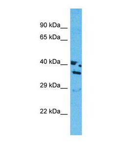 OR13J1 Antibody - Western blot of Human MCF7. OR13J1 antibody dilution 1.0 ug/ml.  This image was taken for the unconjugated form of this product. Other forms have not been tested.