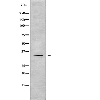 OR14A16 Antibody - Western blot analysis OR5AT1 using COLO205 whole cells lysates