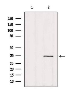 OR14A16 Antibody - Western blot analysis of extracts of HeLa cells using OR5AT1 antibody. Lane 1 was treated with the blocking peptide.