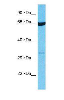 OR14I1 Antibody - Western blot of OR14I1 Antibody with human HT1080 Whole Cell lysate.  This image was taken for the unconjugated form of this product. Other forms have not been tested.