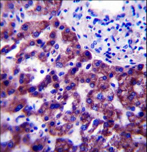 OR14J1 Antibody - OR14J1 Antibody immunohistochemistry of formalin-fixed and paraffin-embedded human liver tissue followed by peroxidase-conjugated secondary antibody and DAB staining.
