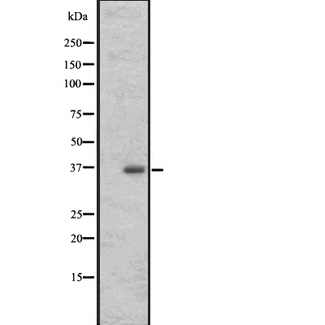 OR17-40 / OR3A1 Antibody - 721_B cells lysate