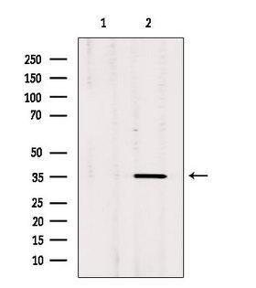 OR17-40 / OR3A1 Antibody - Western blot analysis of extracts of rat brain tissue using OR3A1 antibody. Lane 1 was treated with the blocking peptide.