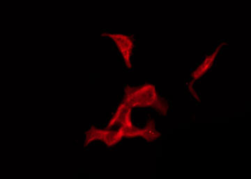 OR1A1 Antibody - Staining COLO205 cells by IF/ICC. The samples were fixed with PFA and permeabilized in 0.1% Triton X-100, then blocked in 10% serum for 45 min at 25°C. The primary antibody was diluted at 1:200 and incubated with the sample for 1 hour at 37°C. An Alexa Fluor 594 conjugated goat anti-rabbit IgG (H+L) Ab, diluted at 1/600, was used as the secondary antibody.