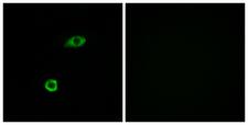 OR1B1 Antibody - Immunofluorescence analysis of A549 cells, using OR1B1 Antibody. The picture on the right is blocked with the synthesized peptide.
