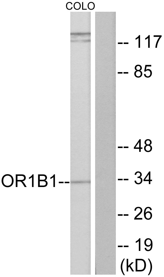 OR1B1 Antibody - Western blot analysis of lysates from COLO cells, using OR1B1 Antibody. The lane on the right is blocked with the synthesized peptide.