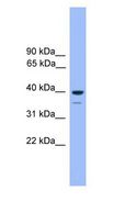 OR1C1 Antibody - OR1C1 antibody Western Blot of 721_B.  This image was taken for the unconjugated form of this product. Other forms have not been tested.