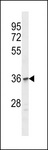 OR1C1 Antibody - OR1C1 Antibody western blot of Jurkat cell line lysates (35 ug/lane). The OR1C1 Antibody detected the OR1C1 protein (arrow).