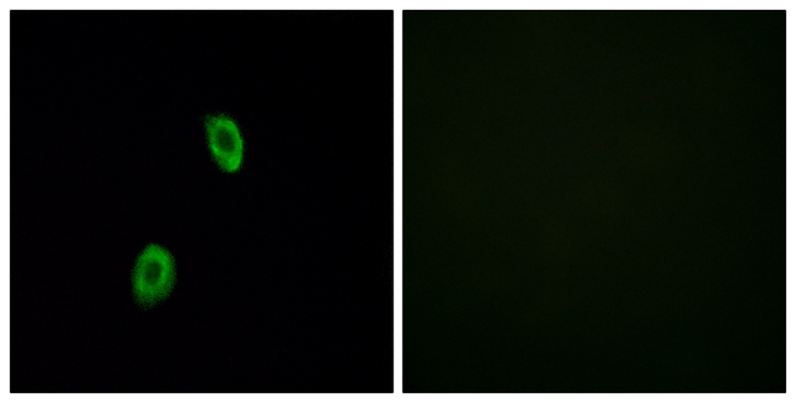 OR1D2 Antibody - Immunofluorescence analysis of HUVEC cells, using OR1D2 Antibody. The picture on the right is blocked with the synthesized peptide.