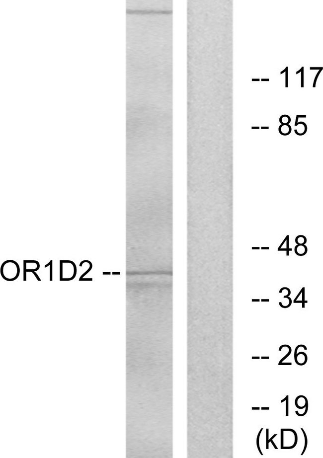 OR1D2 Antibody - Western blot analysis of lysates from Jurkat cells, using OR1D2 Antibody. The lane on the right is blocked with the synthesized peptide.