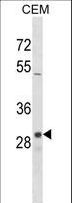 OR1D2 Antibody - OR1D2 Antibody western blot of CEM cell line lysates (35 ug/lane). The OR1D2 antibody detected the OR1D2 protein (arrow).