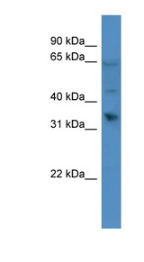 OR1D2 Antibody - OR1D2 antibody Western blot of A549 cell lysate.  This image was taken for the unconjugated form of this product. Other forms have not been tested.
