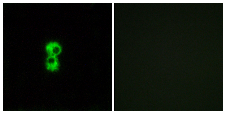 OR1D4+5 Antibody - Immunofluorescence analysis of MCF7 cells, using OR1D4/5 Antibody. The picture on the right is blocked with the synthesized peptide.