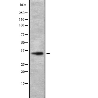 OR1D5 Antibody - Western blot analysis OR1D4/5 using HeLa whole cells lysates