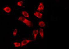 OR1D5 Antibody - Staining HeLa cells by IF/ICC. The samples were fixed with PFA and permeabilized in 0.1% Triton X-100, then blocked in 10% serum for 45 min at 25°C. The primary antibody was diluted at 1:200 and incubated with the sample for 1 hour at 37°C. An Alexa Fluor 594 conjugated goat anti-rabbit IgG (H+L) Ab, diluted at 1/600, was used as the secondary antibody.