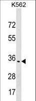 OR1F1 Antibody - OR1F1 Antibody western blot of K562 cell line lysates (35 ug/lane). The OR1F1 antibody detected the OR1F1 protein (arrow).
