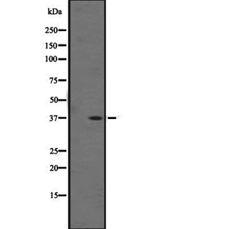 OR1F1 Antibody - Western blot analysis of OR1F1 expression in K562 cells line lysate. The lane on the left is treated with the antigen-specific peptide.