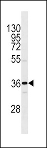 OR1I1 Antibody - OR1I1 Antibody western blot of MDA-MB231 cell line lysates (35 ug/lane). The OR1I1 antibody detected the OR1I1 protein (arrow).