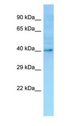 OR1I1 Antibody - OR1I1 antibody Western Blot of Fetal Stomach.  This image was taken for the unconjugated form of this product. Other forms have not been tested.