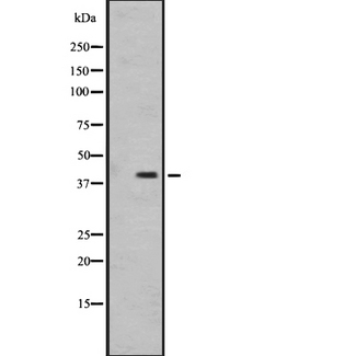 OR1I1 Antibody - Western blot analysis of OR1I1 expression in MDA-MB231 cells line lysate. The lane on the left is treated with the antigen-specific peptide.