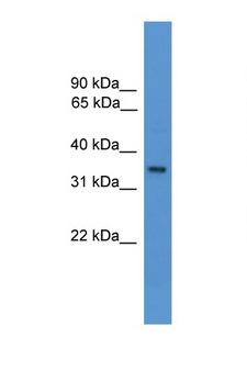 OR1J1 Antibody - OR1J1 antibody Western blot of HeLa Cell lysate. Antibody concentration 1 ug/ml.  This image was taken for the unconjugated form of this product. Other forms have not been tested.