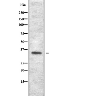 OR1J1 Antibody - Western blot analysis of OR1J1 expression in HEK293 cells. The lane on the left is treated with the antigen-specific peptide.