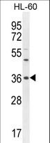 OR1J4 Antibody - OR1J4 Antibody western blot of HL-60 cell line lysates (35 ug/lane). The OR1J4 antibody detected the OR1J4 protein (arrow).