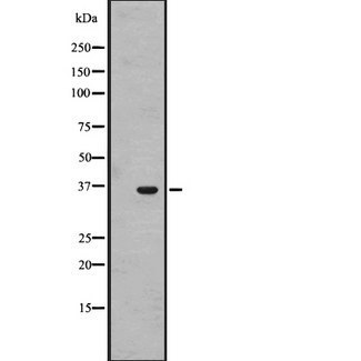 OR1J4 Antibody - Western blot analysis of OR1J4 expression in HL-60 cells line lysate. The lane on the left is treated with the antigen-specific peptide.