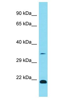 OR1K1 Antibody - OR1K1 antibody Western Blot of Fetal Lung. Antibody dilution: 1 ug/ml.  This image was taken for the unconjugated form of this product. Other forms have not been tested.