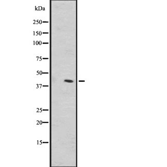 OR1L1 Antibody - Western blot analysis of OR1L1 expression in A549 whole cells lysate. The lane on the left is treated with the antigen-specific peptide.