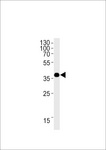 OR1L3 Antibody - OR1L3 Antibody western blot of HepG2 cell line lysates (35 ug/lane). The OR1L3 antibody detected the OR1L3 protein (arrow).