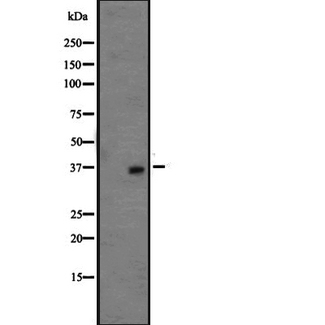 OR1L3 Antibody - Western blot analysis of OR1L3 expression in HepG2 cells lysate. The lane on the left is treated with the antigen-specific peptide.