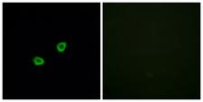 OR1L6 Antibody - Immunofluorescence analysis of HUVEC cells, using OR1L6 Antibody. The picture on the right is blocked with the synthesized peptide.