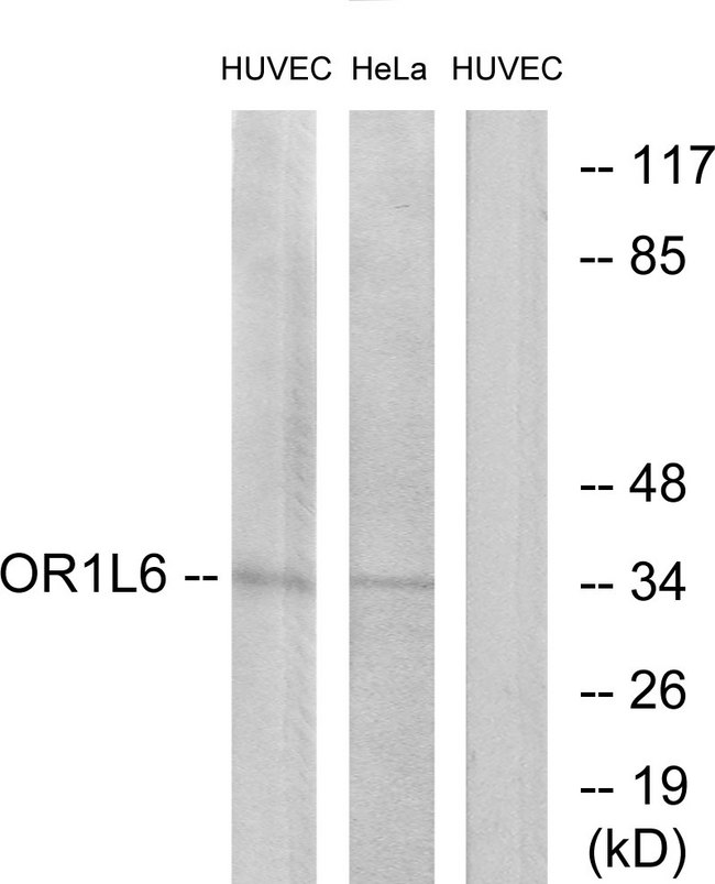 OR1L6 Antibody - Western blot analysis of lysates from HUVEC and HeLa cells, using OR1L6 Antibody. The lane on the right is blocked with the synthesized peptide.