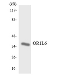 OR1L6 Antibody - Western blot analysis of the lysates from COLO205 cells using OR1L6 antibody.